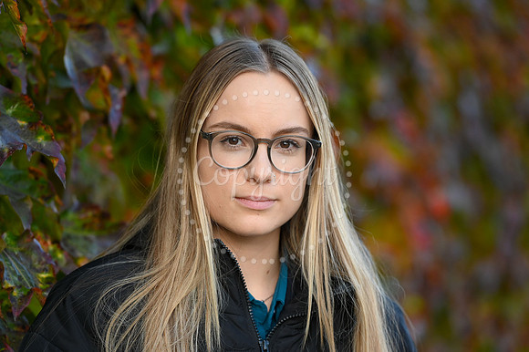 Katie Gill, from Bury, has a rare skin condition, but despite an